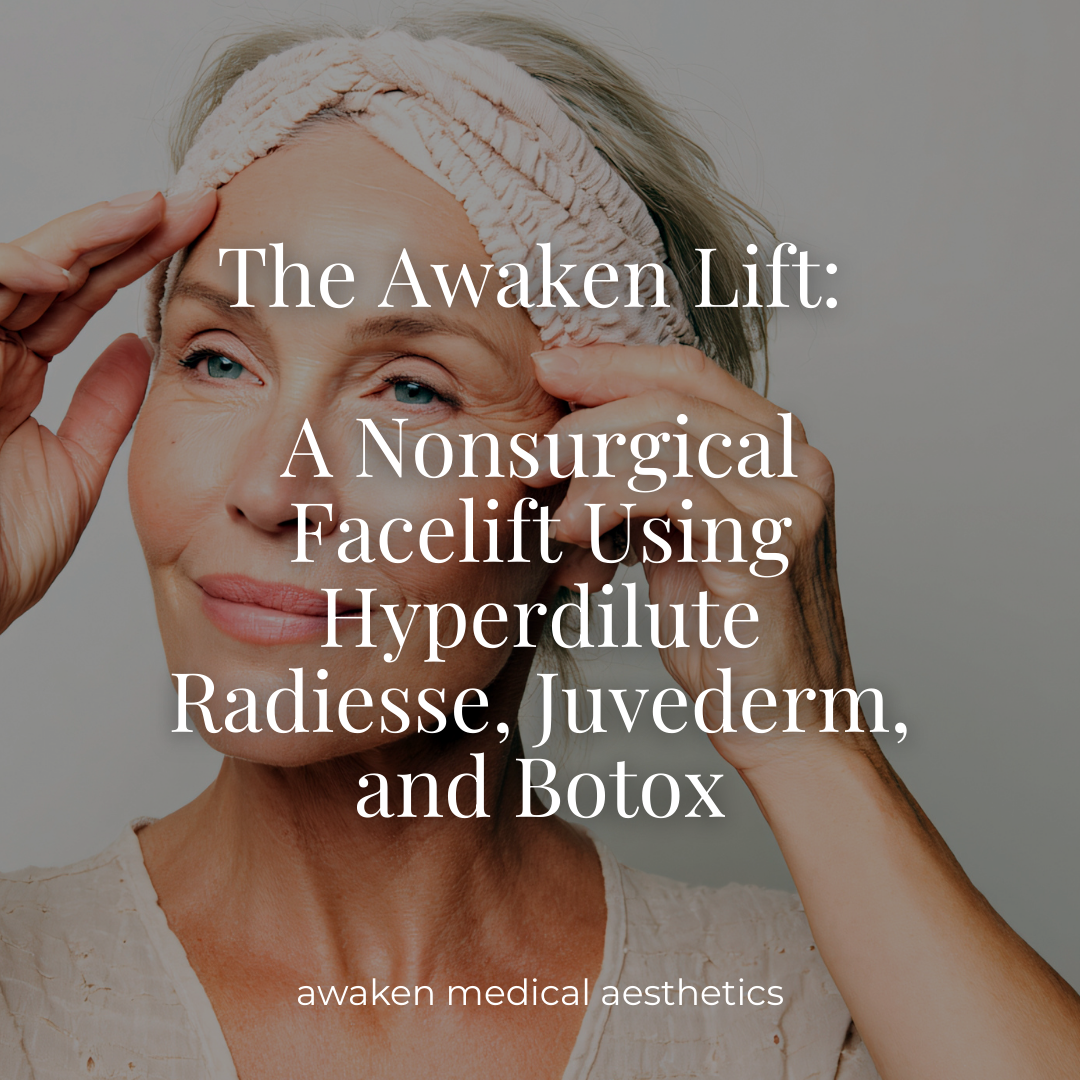 Awaken Medical Aesthetics Nonsurgical Facelift in Amarillo, Texas