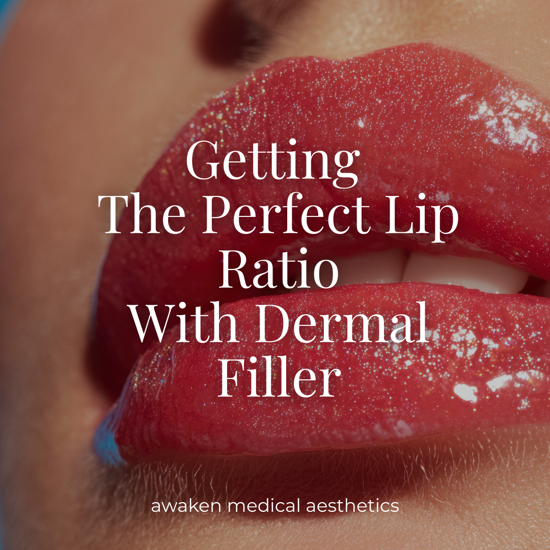 Getting The Perfect Lip Ratio With Dermal Filler – Awaken Medical Aesthetics