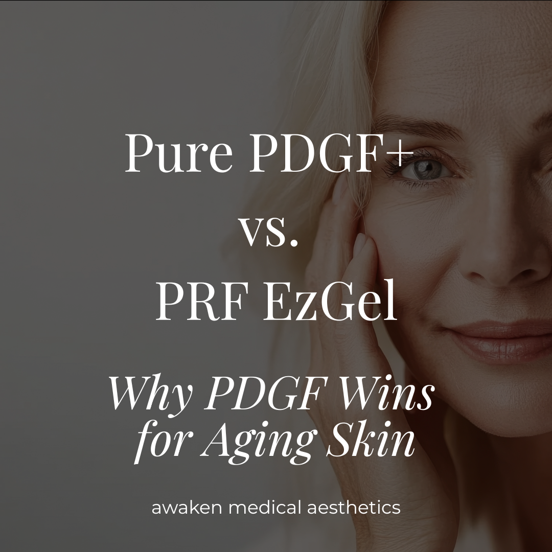 Pure PDGF+ versus PRF EzGel- Why PDGF Wins For Aging Skin- Awaken Medical Aesthetics