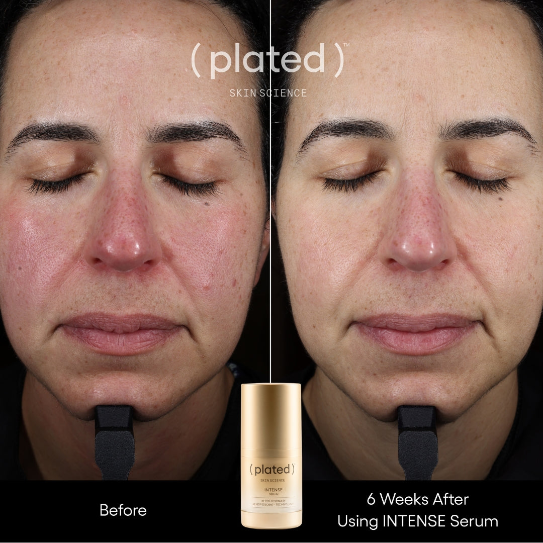 Plated_Intense_Serum_Advanced_Anti-Aging_Peptide_Treatment-_Before_and_After