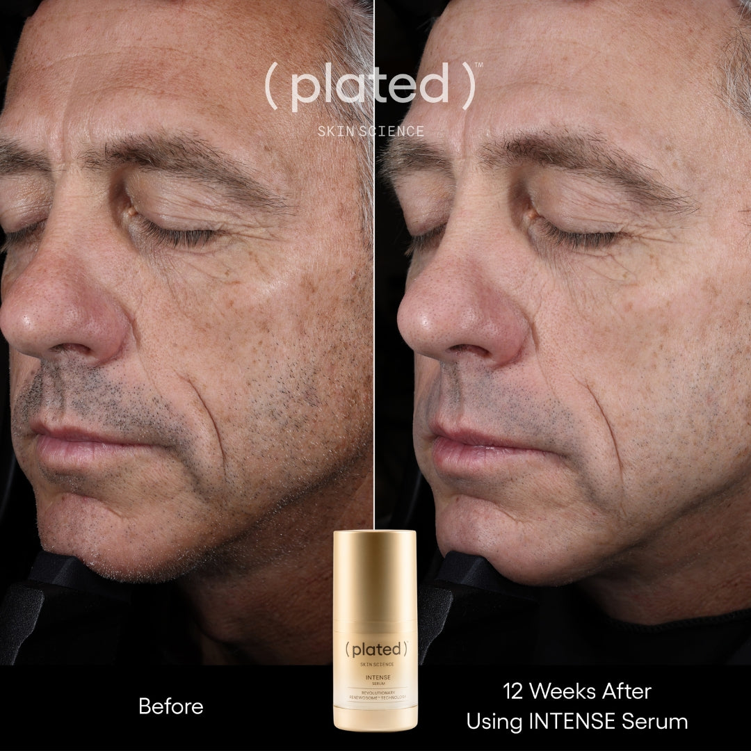 Before and after comparison of a man's face with 'plated' serum, showing visible skin improvement.