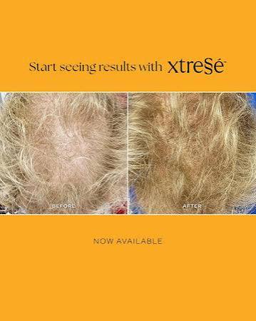 Xtresse Hair Therapy