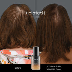 Before and After Plated Hair Serum- Female Hair Thinning- Hormonal Hair Loss