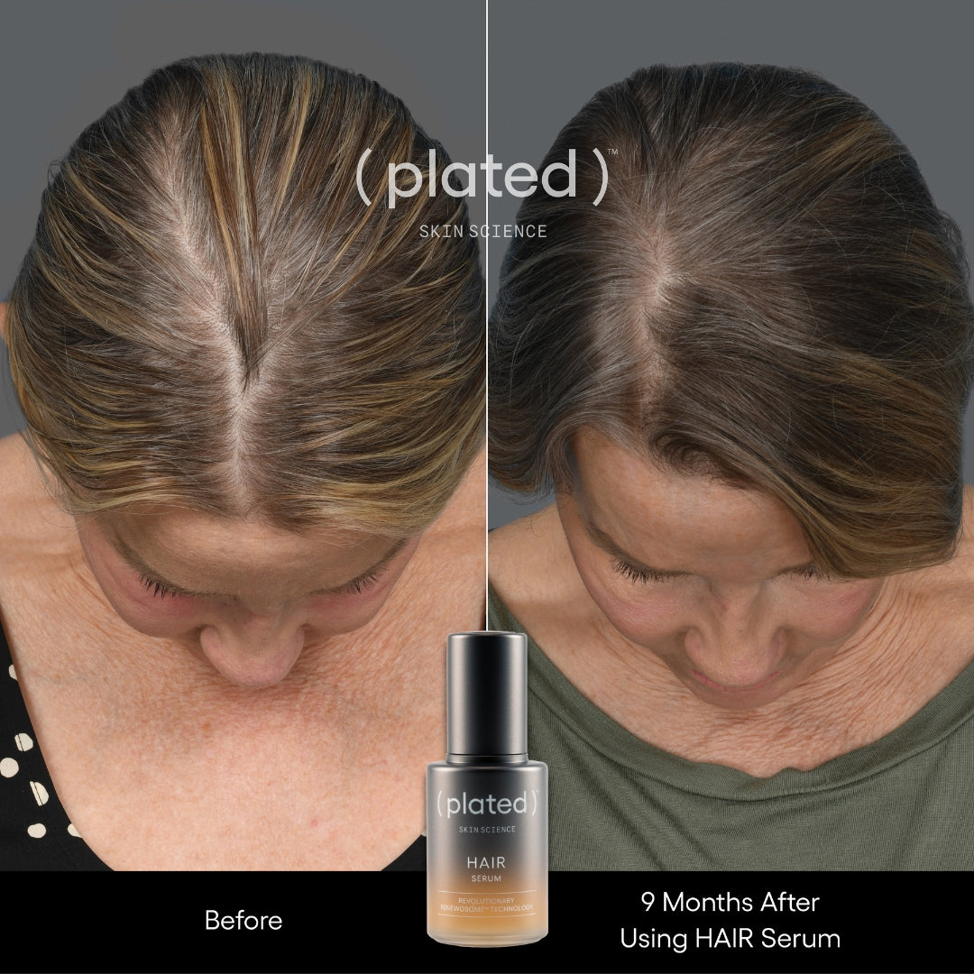 Before and after comparison of hair using a HAIR SERUM by Plated- Before and After Plated Hair Serum- Female Hair Thinning- Hormonal Hair Loss 2