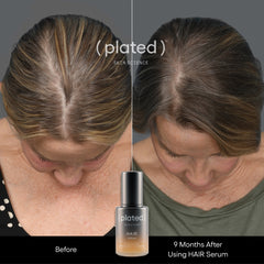Before and after comparison of hair using a HAIR SERUM by Plated- Before and After Plated Hair Serum- Female Hair Thinning- Hormonal Hair Loss 2