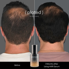 Before and After Plated Hair Serum- Mail Hair Thinning At The Crown