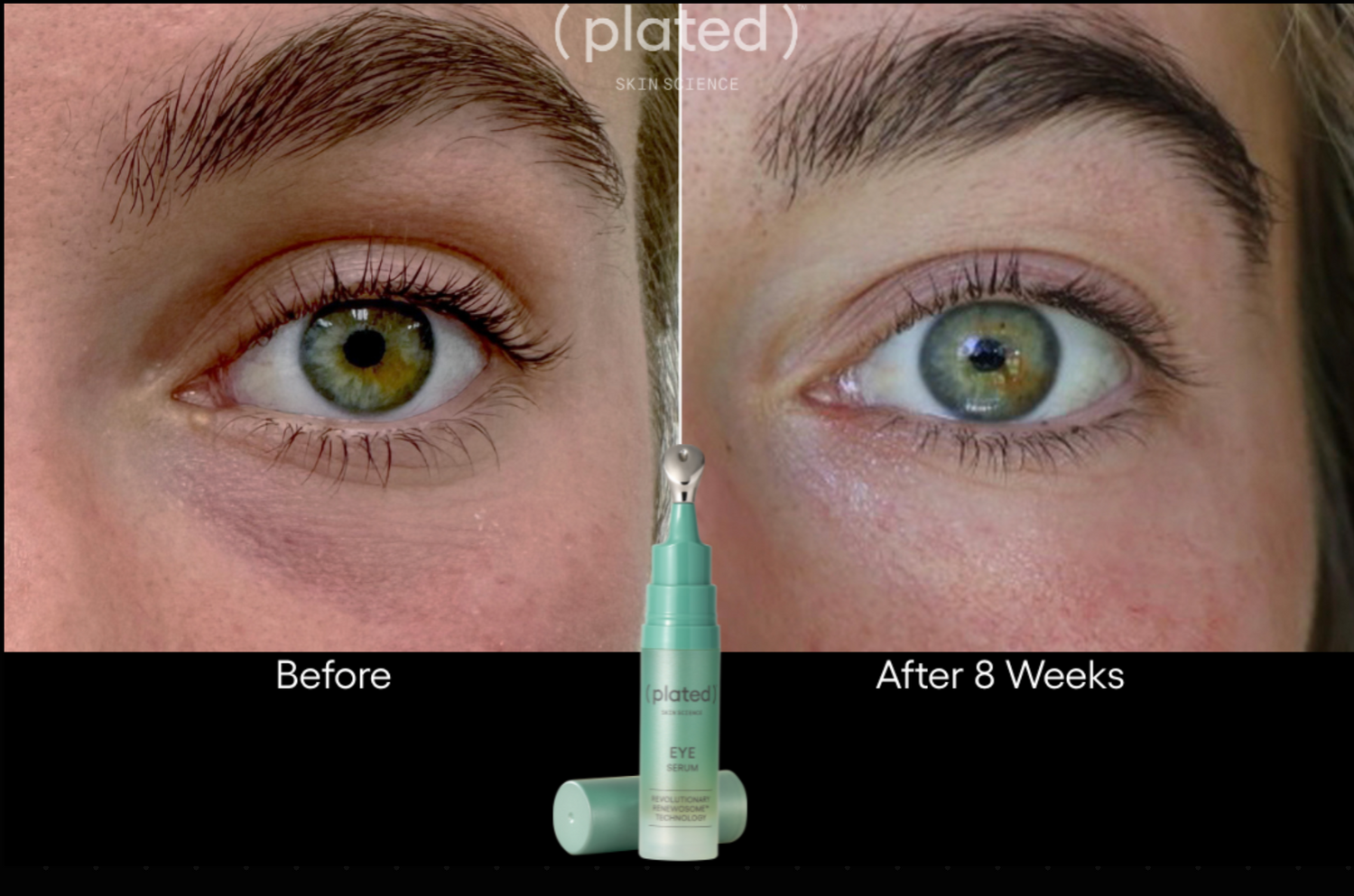 Before and after comparison of eye treatment with a product shown.