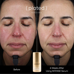 Plated_Intense_Serum_Advanced_Anti-Aging_Peptide_Treatment-_Before_and_After