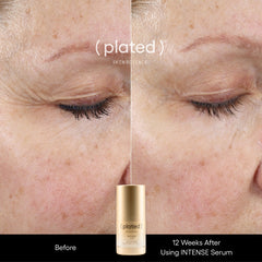 Plated_Intense_Serum_Advanced_Anti-Aging_Peptide_Treatment-_Before_and_After